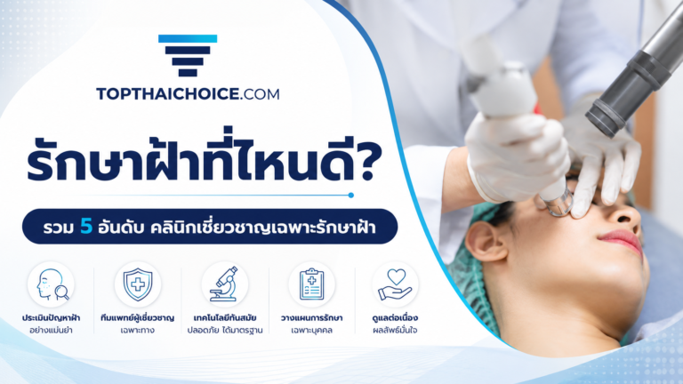 รักษาฝ้าที่ไหนดี? รวม 5 อันดับคลินิกเชี่ยวชาญเฉพาะรักษาฝ้า